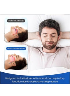 RATSAW Nasal Strips 100pcs Anti Snore Nasal Strips  Free Nose Strips Universal Adjustable Stop Snoring Sleeping Aid For Snoring Women And Men  - Image 5