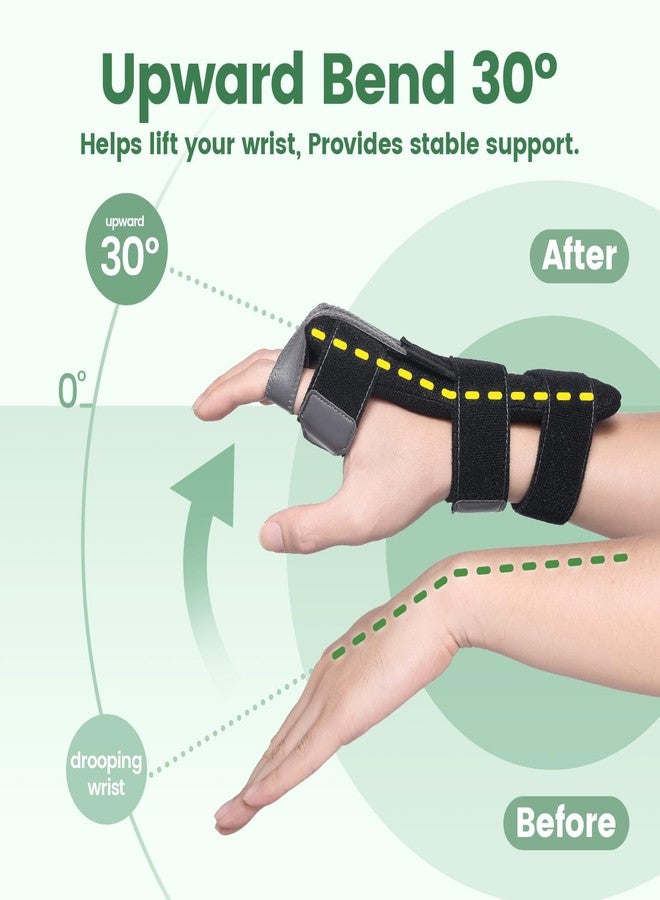 DrFinger Radial Nerve Palsy Brace Splint for Finger Extension, Wrist Drop, Crutch Palsy, Mcp Arthroplasty, Radial Nerve Injury, Finger Limp, Stroke Recovery, Adjustable Hand Stabilizer fit Right & Left Hand - Image 3