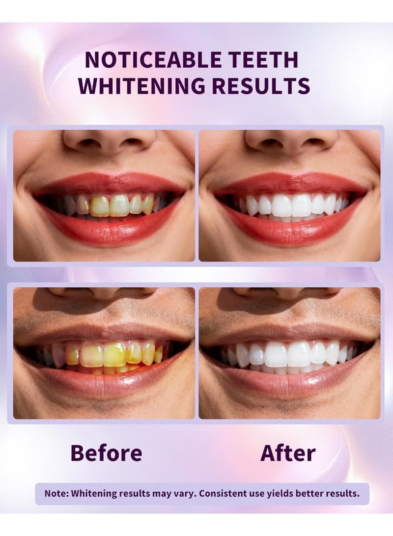 SMILEKIT Purple Whitening Strips, Gently Remove Tooth Stains, Protect Tooth Enamel, Use Advanced 9d Whitening Technology to Create A Brighter Smile, Enamel Safe for Sensitive Tooth, 28 Strips - Image 5