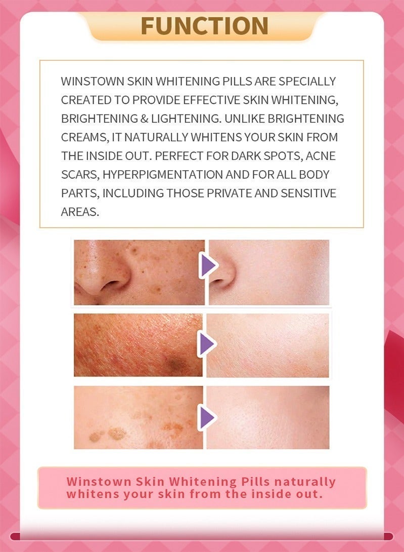 Wins Town Collagen Tablets 60 Capsules for Dark Spots, Melasma, Acne Scar Remover and Anti-Aging Signs - Image 3