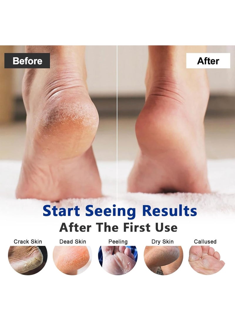 Kanza كريم قدم 85 جرام 40% يوريا لإصلاح القدمين الجافتين والمتشققتين ترطيب فائق 24 ساعة إزالة الجلد الخشن كريم للعناية بالقدمين واليدين لوشن يشفي ويهدئ ويستعيد وينعش البشرة لوشن - Image 4