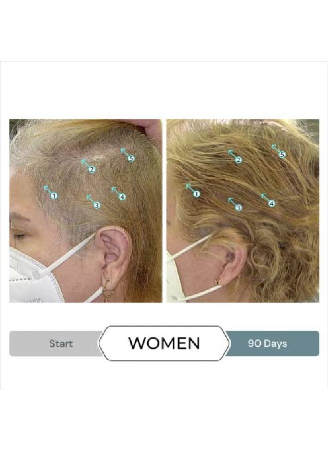DS LABORATORIES Revita.Sod Hair Growth Supplement By Experience Fuller Thicker Stronger Hair Combat Hair Loss And Hair Thinning Caused By Stress Reduce Hair Thinning Balding And Hair Shedding (30 Day Supply)  - Image 5