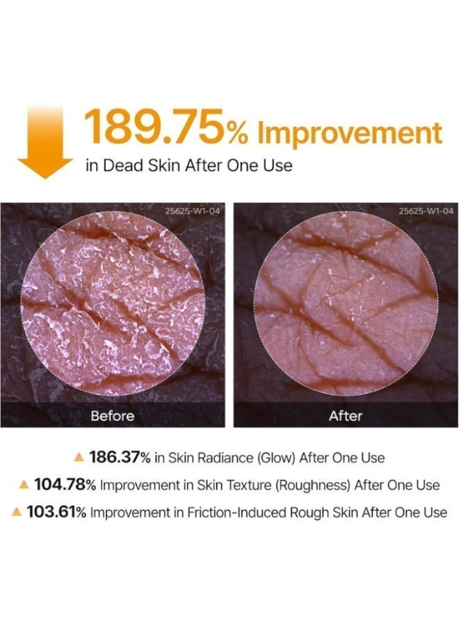 2PCS Dark Spots, Dull Skin & Uneven Tone Corrector — Dr Peel Shot Exfoliating Kojic Acid & Turmeric Brightening Spray - Image 5