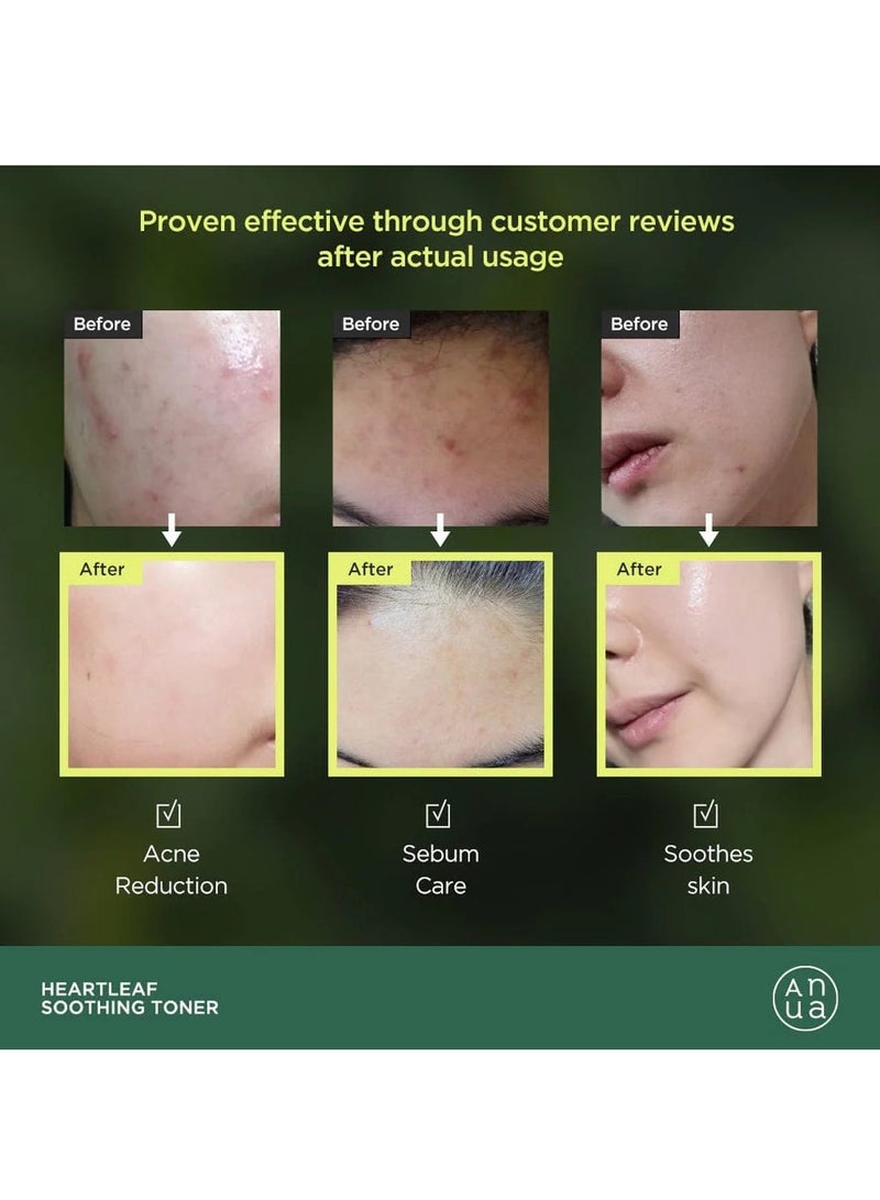 دي آر.ألثيا كريم دكتور ألثيا المهدئ والمرطب 345، 50 مل + تونر هارت ليف المهدئ 77% 250 مل - Image 5