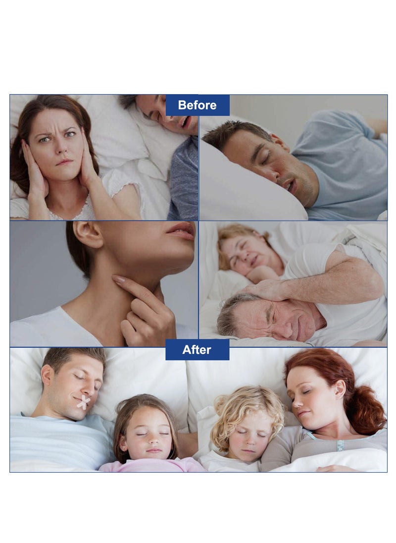 120Pcs X-Shaped Mouth Breathing Correction Patch, Sleep Closed Mouth Patch, Healthy Nasal Breathing And Anti-Snoring Artifact, Nighttime Sleeping, Mouth Breathing, And Loud Snoring