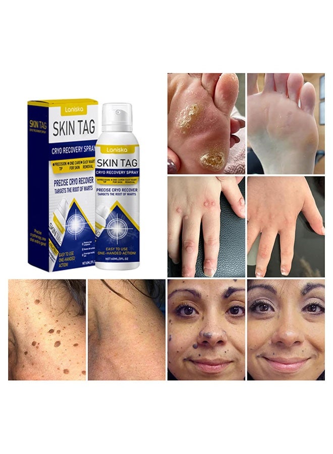 LANISKA ChillErase Bump Renewal Spray, Advanced Salicylic Acid Body Spray 2%, Natural Skin Spray-60ml, Suitable for All Skin Types - Image 3