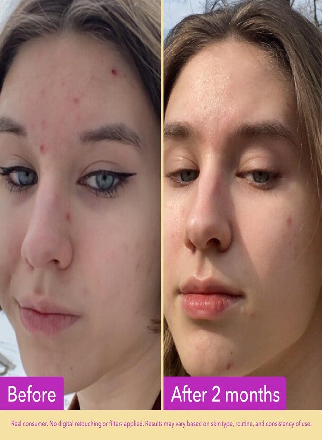 Good Molecules Niacinamide Serum Pack 3 – 30 ml Each (Total 90 ml) | 10% Niacinamide Serum to Target Blemishes, Uneven Skin Tone & Enlarged Pores - Image 3