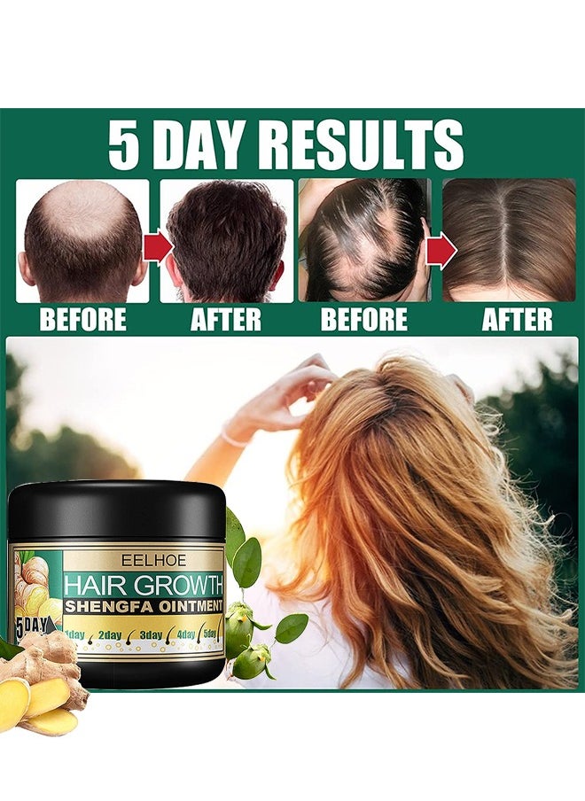 EELHOE - Ginger Hair Growth Shengfa Ointment, Ginger Germinal Conditioner, 5 Days Hair Regrowth Cream, Moisturizing Scalp Massage Follicle Ginger Essence Cream For Hair Loss And Hair Thinning Treatment - Image 1