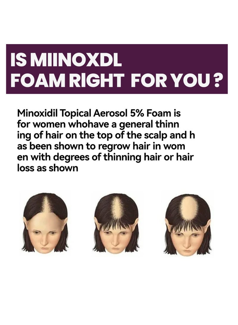SYOSI Hair-Revive Foam Shampoo, Hair-Revive Foam Shampoo, Biotin and Collagen Shampoo Hair Growth Shampoo, Thickening Hair’s Appearance, For Hair Growth, For All Hair Types (3PCS) - Image 3