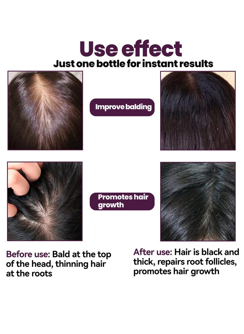SYOSI Hair-Revive Foam Shampoo, Hair-Revive Foam Shampoo, Biotin and Collagen Shampoo Hair Growth Shampoo, Thickening Hair’s Appearance, For Hair Growth, For All Hair Types (3PCS) - Image 4