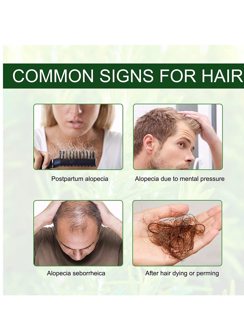 iBeaLee  Hair Lotion - Hair Root Nutrients 30ml - Image 2