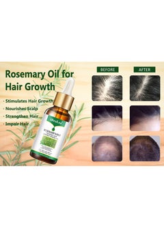 iBealee iBeaLee  Hair Lotion - Hair Root Nutrients 30ml  - Image 3