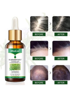 iBealee iBeaLee  Hair Lotion - Hair Root Nutrients 30ml  - Image 5