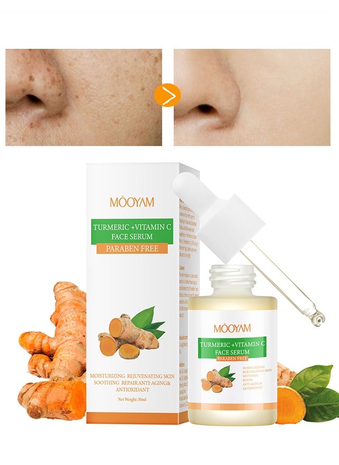 MOOYAM - Turmeric + Vitamin C Face Serum -  Face Dark Spot Correcting Glow Serum Dark Spot Remover for Face Tumeric Serum Acne Dark Spots Hyperpigmentation Smooth Skin 30ml - Image 1