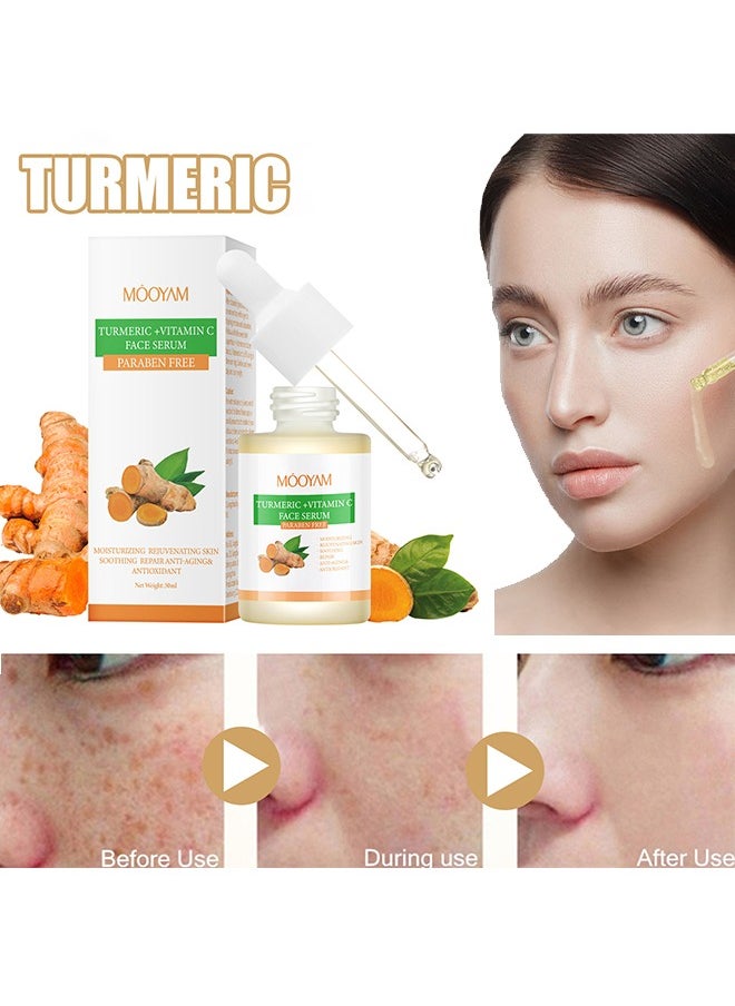 MOOYAM - Turmeric + Vitamin C Face Serum -  Face Dark Spot Correcting Glow Serum Dark Spot Remover for Face Tumeric Serum Acne Dark Spots Hyperpigmentation Smooth Skin 30ml - Image 1