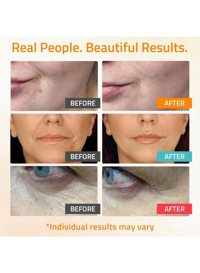 Yeouth Skin Care Set: Hyaluronic Acid Serum for Face, Retinol Serum for Face and Vitamin C, Skincare Set Targets Appearance of Uneven Skin Tone and Dryness 3x1 oz  - Image 3