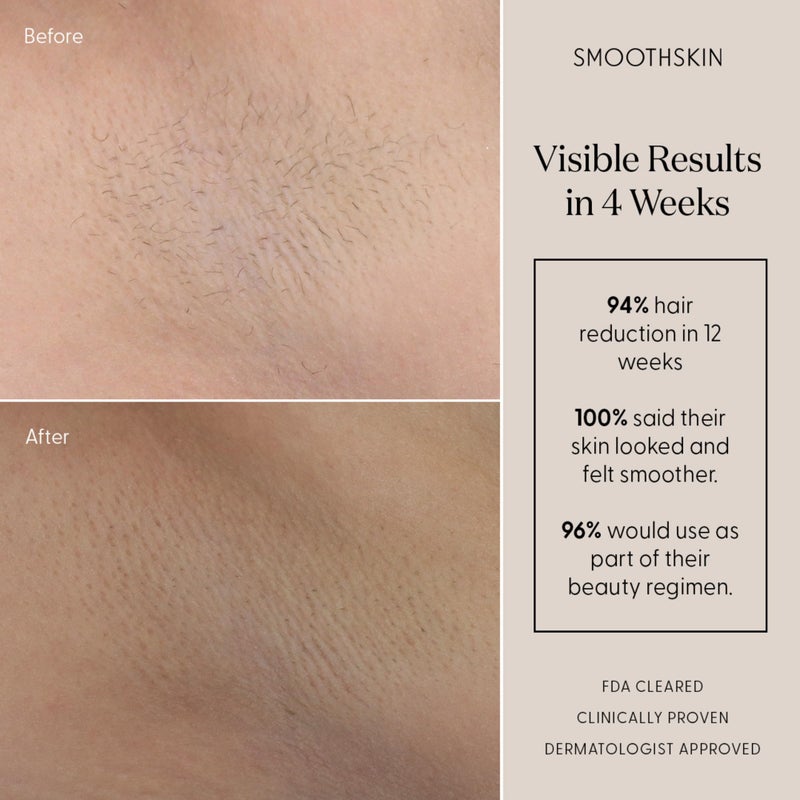 SmoothSkin Pure Mini IPL Laser Hair Removal Device, Long-Lasting, for Body & Facial Hair Removal, Alternative to Laser Hair Removal, Bikini Shaver & Epilator, with Precision Head for Small Areas - Image 4