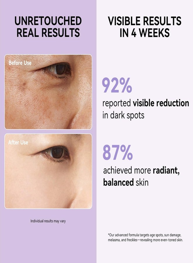 DMYGO Dark Spot Remover for Face and Body - Dark Spot Corrector Serum for Sun Spots, Age Spots, Brown Spot, Freckles & Melasma - Skin Care Repair Evens Skin Tone for All Skin Type 1.7 Fl Oz - Image 2