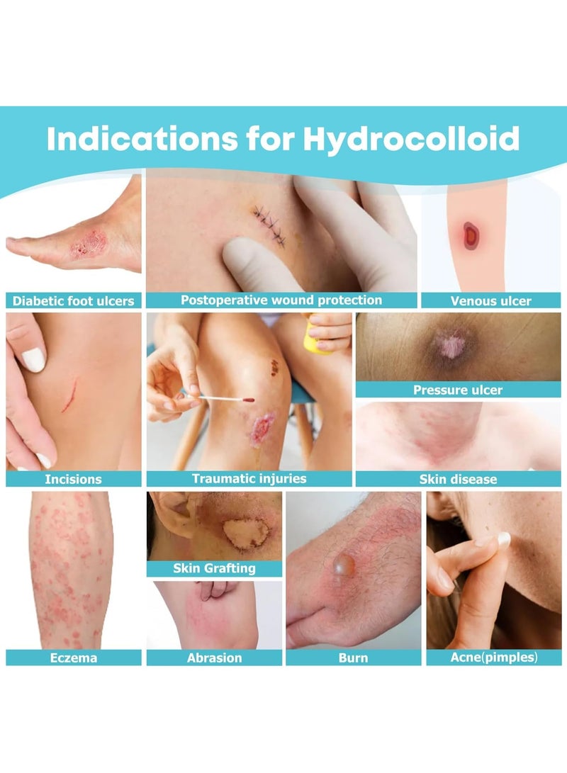 لفافة غرواني مائي للعناية بالجروح - ضمادات غرواني مائي كبيرة جدًا قابلة للقص حسب المقاس مع لاصق ذاتي - فائقة الامتصاص، مرنة، ومقاومة للماء، وأساسية في مجموعة الإسعافات الأولية (5 سم × 5 م). - Image 4