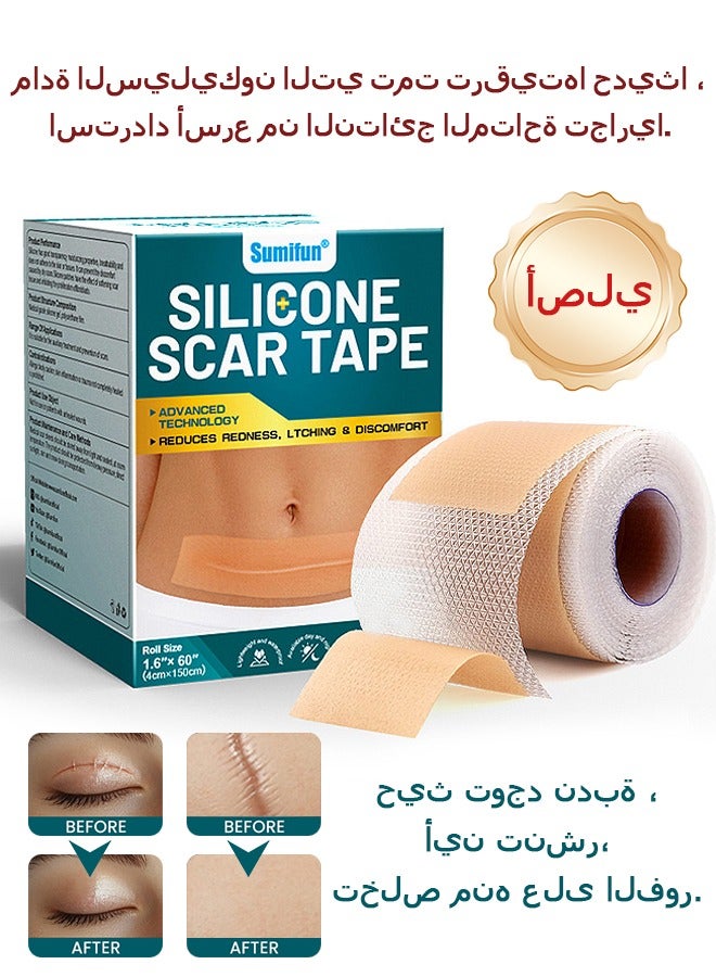 Sumifun Silicone Scar Tape, Medical Silicone Scar Remover Sheet, Reusable Tape for C-Section, Keloid, and Surgical Scars 4cm*1.5m - Image 1