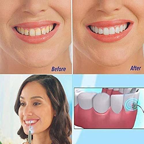 BANCROFT Dental Care Water-Jet Flosser Air technology Cords Tooth Dental Cleaning Whitening Teeth Kit Power Floss Air Powered Dental Water Jet for Tooth Cleaner (White) - Image 4