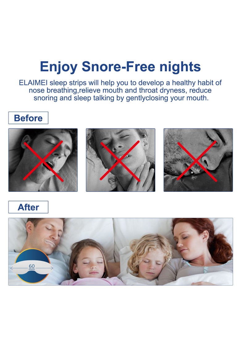 Elaimei - 90 Pcs Mouth Tape Sleep Strip For Anti-snoring Mouth Breathing Tape To Improve Sleep Mouth Stickers For Snoring Lip Patch - Image 1