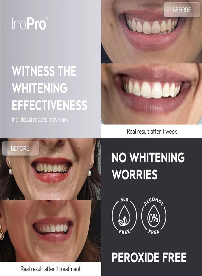 InoPro Natural Teeth Whitening Strips Kit 21 Treatments - Sensitive Teeth Whitener, Peroxide Free, Enamel Safe White Strips - Instant Teeth Whitening Without The Harm (42 Strips) - Image 2