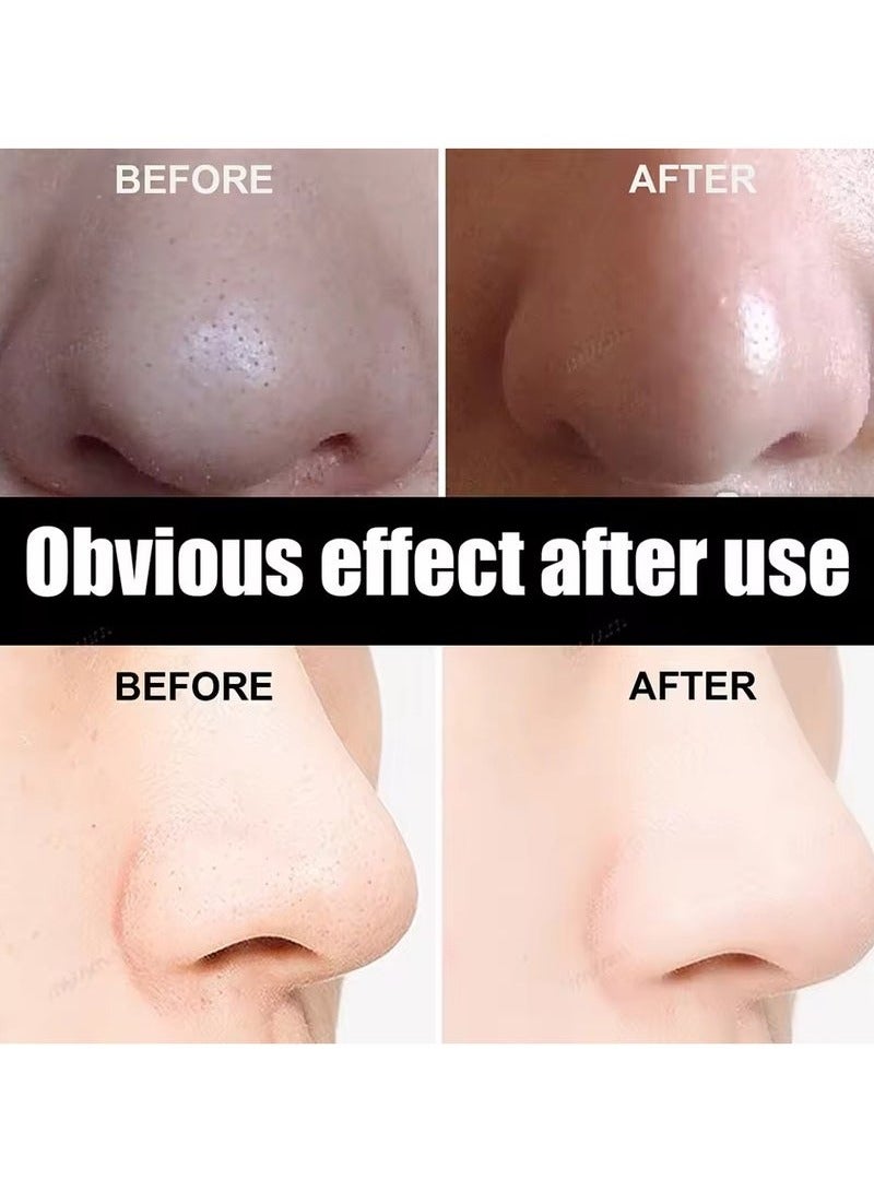 ATRJSZ Unisex Blackhead Remove Mask Peel Nasal Strips Deep Shrink Cleansing Pore Nose Black Head Remove Stickers Skin Care Mask Patch(10PCS) - Image 4