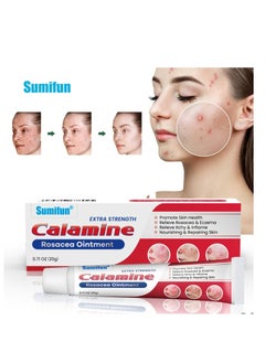 Sumifun Calamine Rosacea Ointment Relieve Rosacea Eczema Extra Strengh 20G  - Image 1