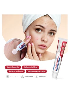 Sumifun Calamine Rosacea Ointment Relieve Rosacea Eczema Extra Strengh 20G  - Image 3