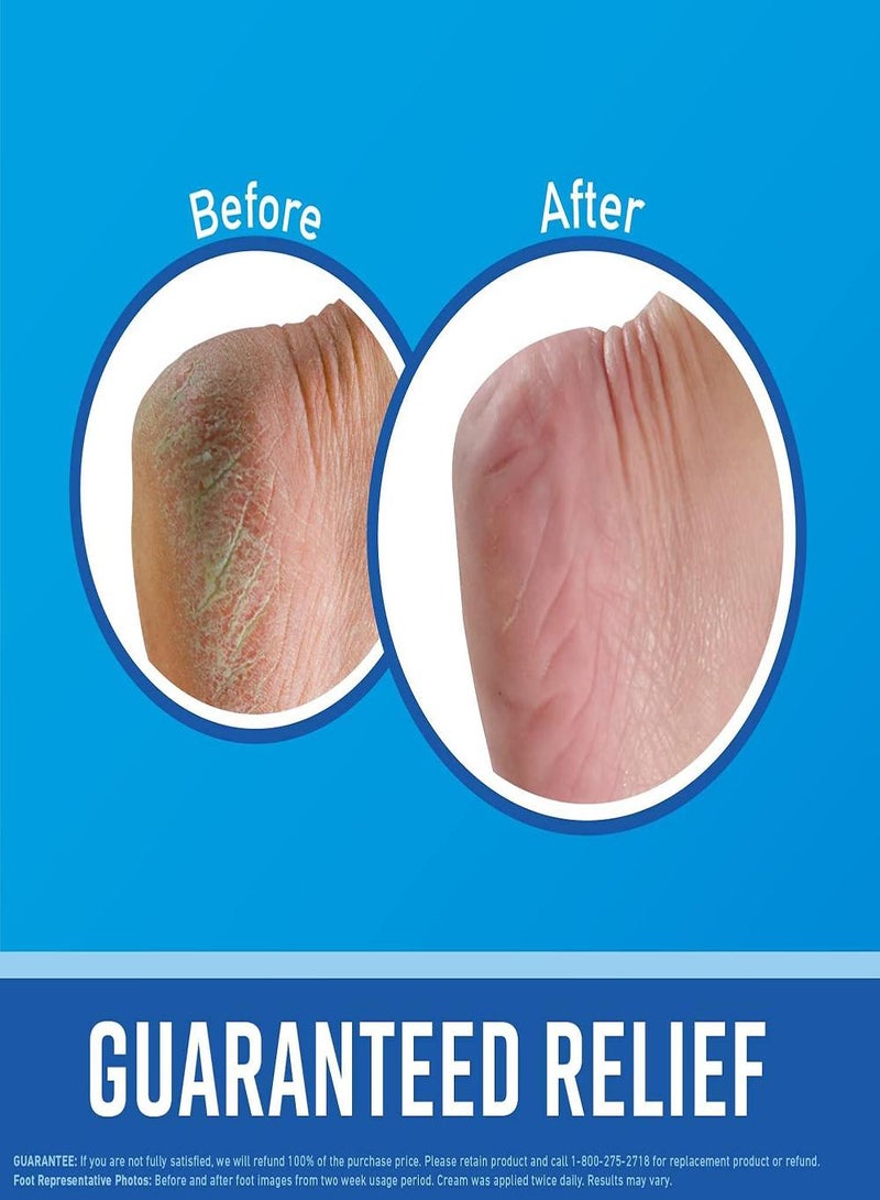 أوكيفيس كريم O’Keeffe’s Healthy Feet للعناية بالقدمين 76جرام *2 - Image 3