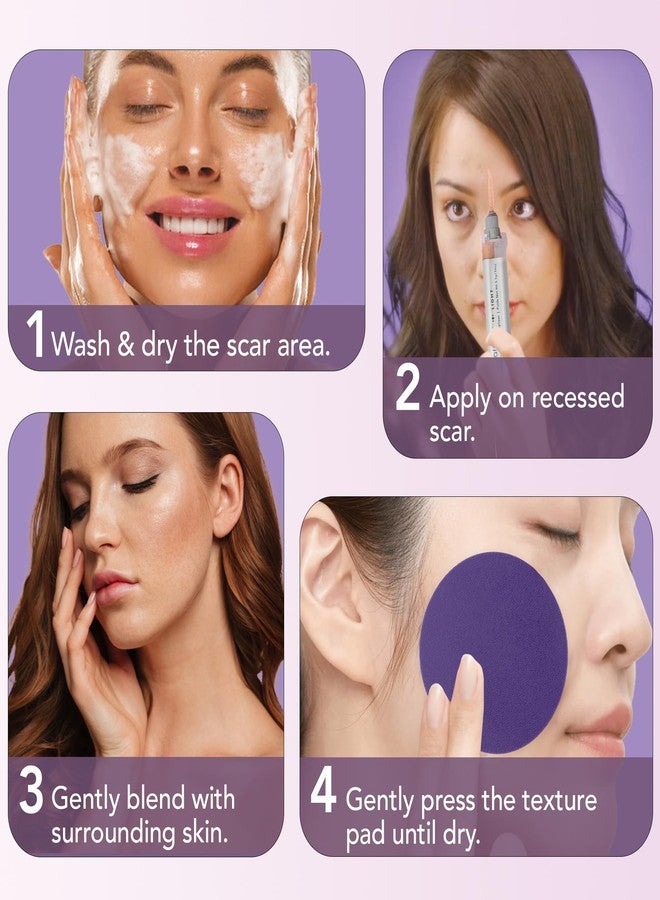 Dermaflage Scar Filler Kit - Light - Deep Scar Cover and Waterproof Concealer for Acne Scars Wrinkles, and Ice Pick Scars Makeup, 1 mo supply - Image 4