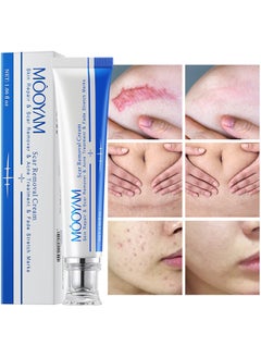 MOOYAM Scar Removal Cream, Skin Repairing Cream Fade Scars And Stretch MarksAnd Acne Treatment, Improve Scar Skin, Deeply Moisturizes Skin, For Surgical Scars Stretch Marks Acne Old Or New Scars  - Image 1