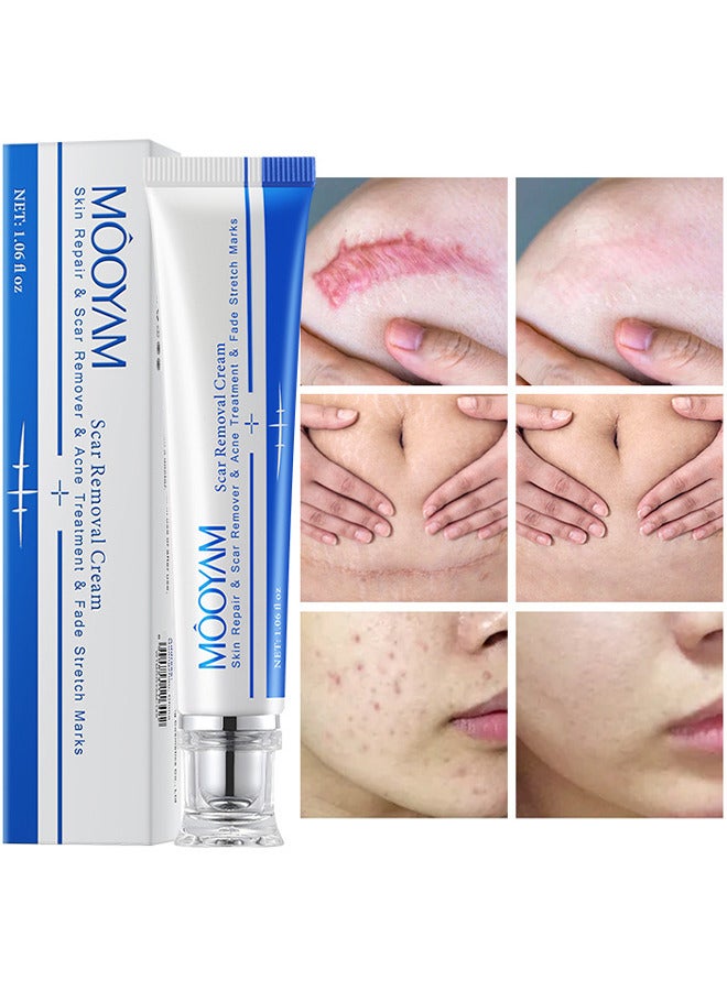MOOYAM Scar Removal Cream, Skin Repairing Cream Fade Scars And Stretch MarksAnd Acne Treatment, Improve Scar Skin, Deeply Moisturizes Skin, For Surgical Scars Stretch Marks Acne Old Or New Scars  - Image 1
