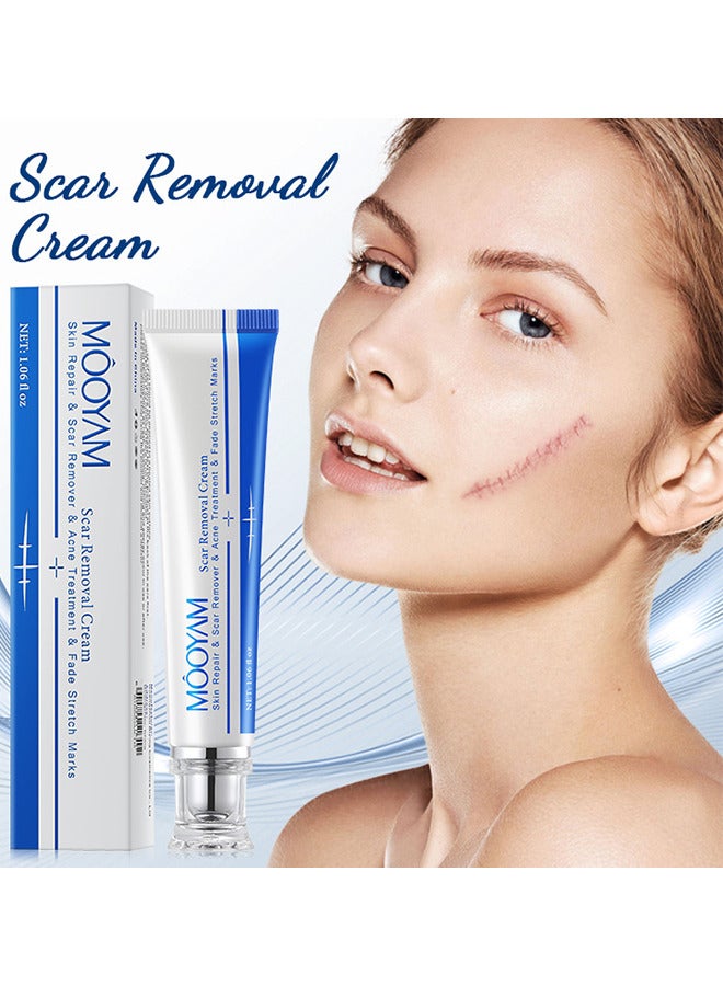 MOOYAM Scar Removal Cream, Skin Repairing Cream Fade Scars And Stretch MarksAnd Acne Treatment, Improve Scar Skin, Deeply Moisturizes Skin, For Surgical Scars Stretch Marks Acne Old Or New Scars  - Image 2
