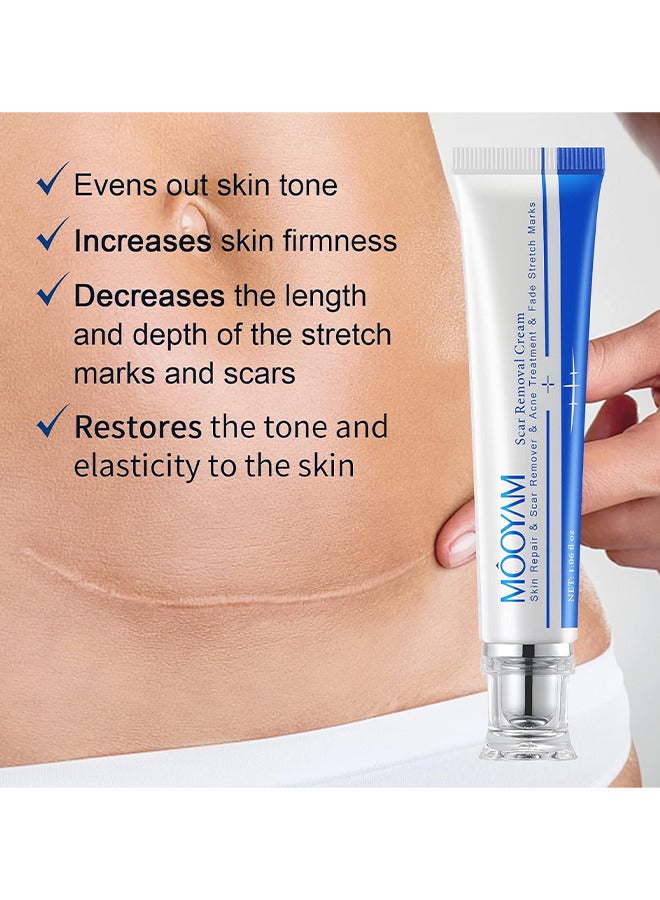 MOOYAM Scar Removal Cream, Skin Repairing Cream Fade Scars And Stretch MarksAnd Acne Treatment, Improve Scar Skin, Deeply Moisturizes Skin, For Surgical Scars Stretch Marks Acne Old Or New Scars  - Image 5