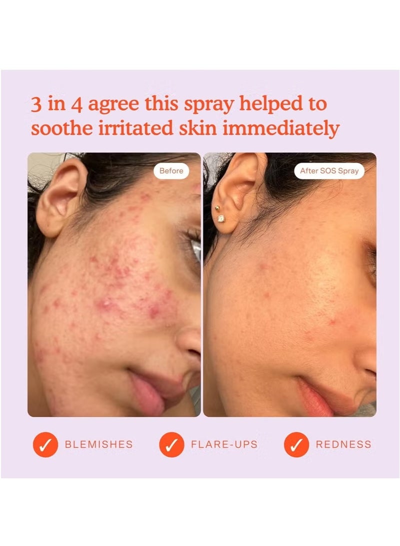 تاور 28 بخاخ الوجه اليومي Tower 28 SOS - تونر معجزة متوازن للرقم الهيدروجيني! تركيبة حمض الهيبوكلوروس للبشرة فائقة الحساسية، 4 أونصة سائلة - Image 4