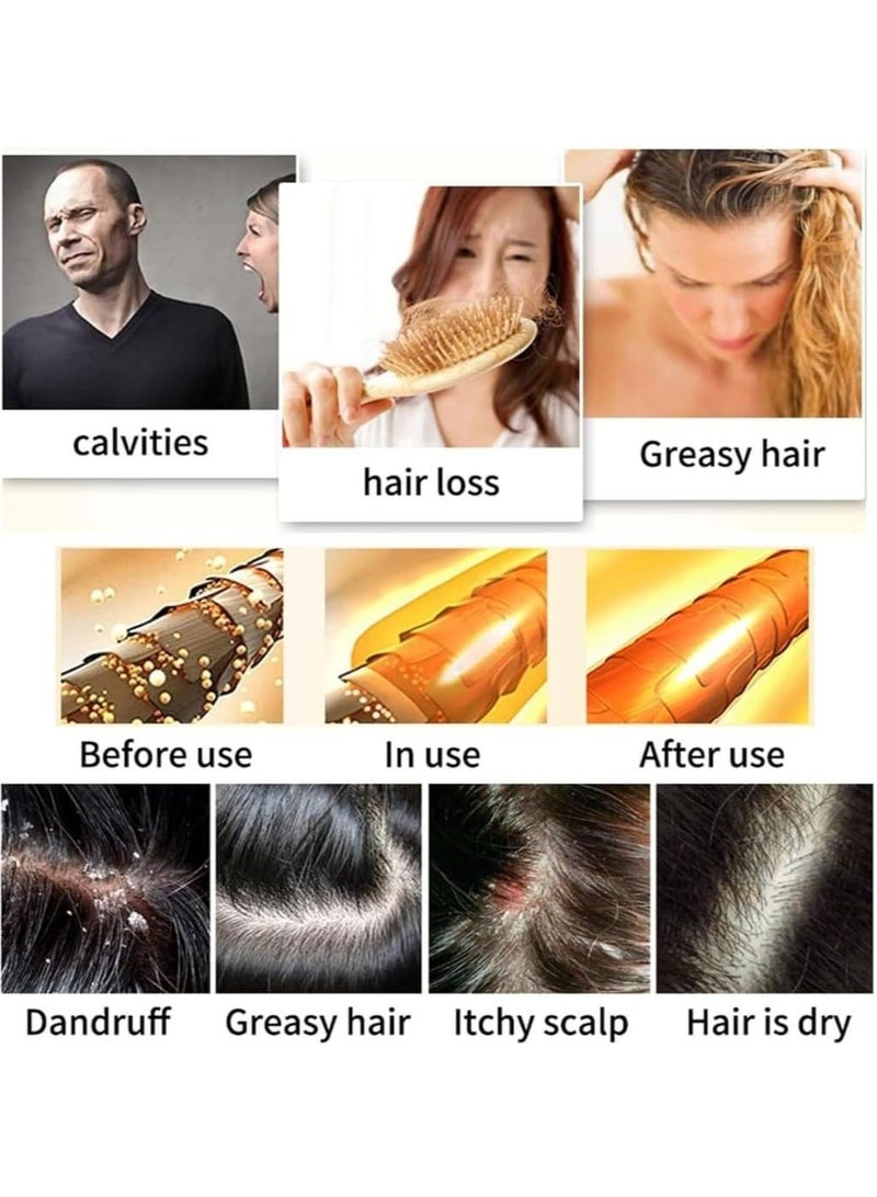 NIKITA.VIVI بار شامبو نمو الشعر روزماري 60 جرام يمنع تساقط الشعر ويعزز نمو بصيلات الشعر صابون روزماري عضوي للتحكم في الزيت تنظيف عميق تهدئة فروة الرأس تقوية جذور الشعر - Image 2