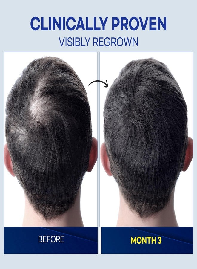 ProBliva Minoxidil Hair Growth Treatment for Men: Clinically Proven 5% Minoxidil Treatment for Hair Loss & Thinning - Extra Strength Hair Regrowth Treatment & Scalp Nourishment - Made in USA - 2 FL OZ - Image 4