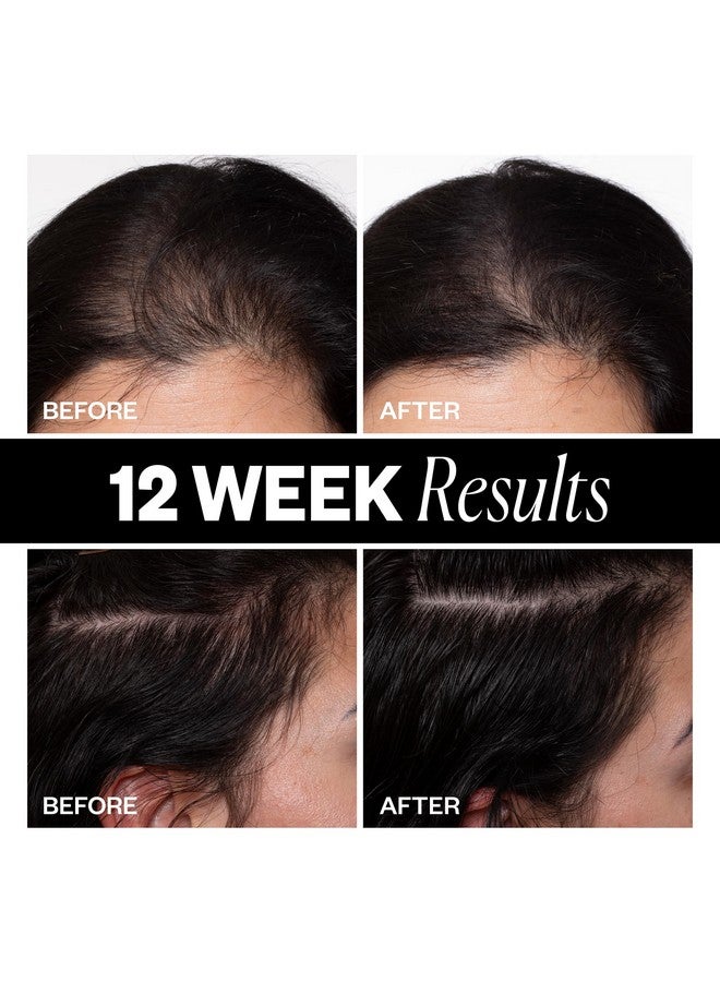 أي جي كي علاج فروة الرأس لكثافة الشعر برعاية IGK 63 مل / 2.1 أونصة - Image 4