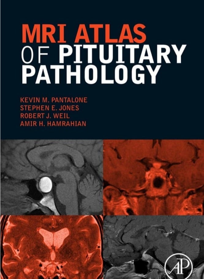MRI Atlas of Pituitary Pathology (Hardcover Edition) - Image 1
