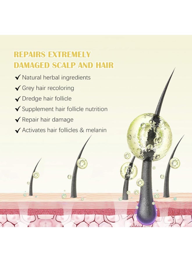 5% Minoxidil for Men u0026 Women With Derma Roller, Minoxidil for Women Hair Growth, Minoxidil for Men Beard, Natural Hair Regrowth Treatment for Hair Loss Hair Thinning, Thicker Fuller Healthier Ha