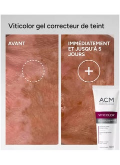 ACM Laboratoire dermatologique Viticolor Skin Tone Unifying Gel  - Image 4