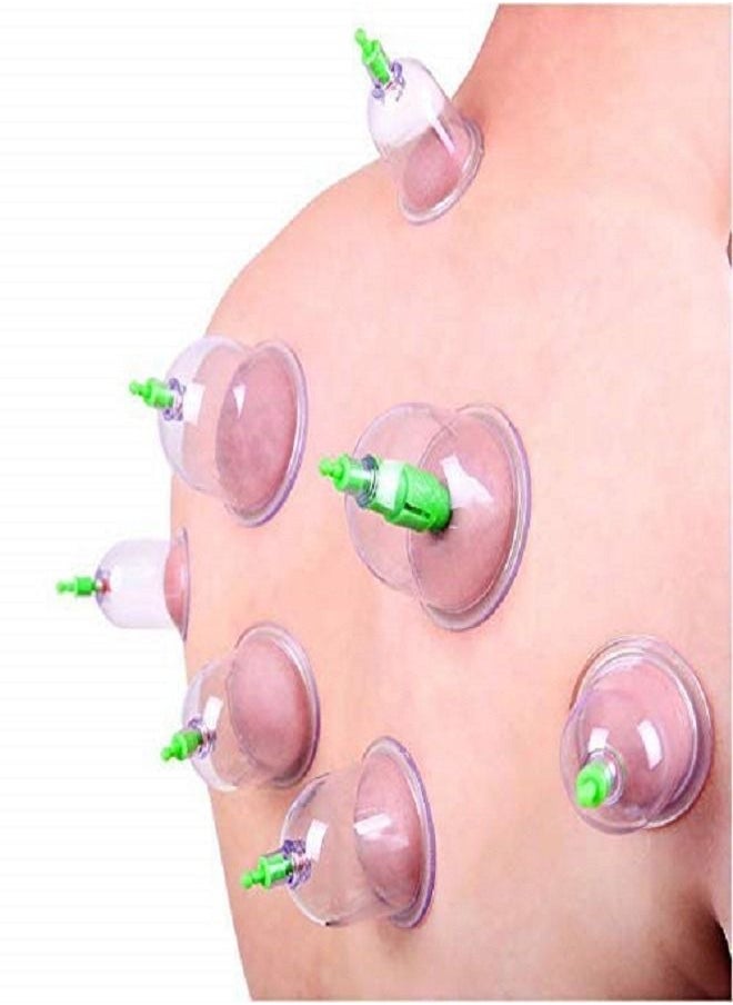 ABC Twelve Cup Islamic Cupping Set with Suction Device Peace and Rejuvenation  - Image 3
