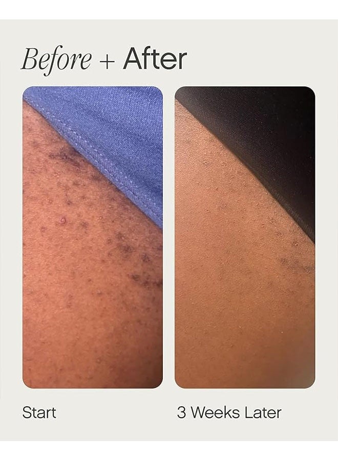 TOPICALS Ingrown Tonic Lolion Tonique Pour Poils Incarnes 50ml, High Roller Ingrown Hair Tonic, Daily Treatment for Razor Bumps, Irritation and Ingrown Hairs, Suitable for Face and Body - Image 3