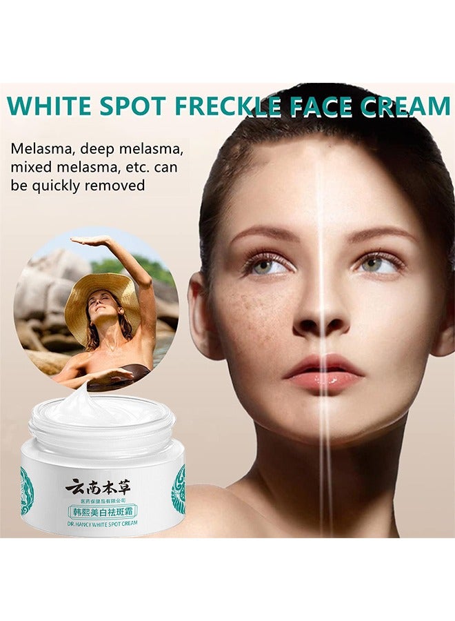 Hancy Freckle Whitening Cream To Remove Dark Spots And Melasma Remover, Dark Spot Corrector, Yunnan Herbal Freckle-Removing Cream, 20G - Image 3