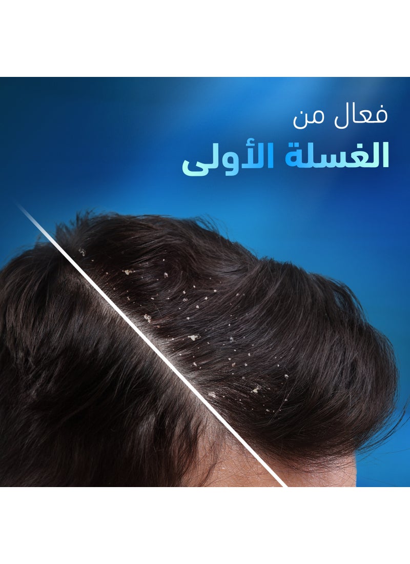 Head & Shoulders Anti-Dandruff Shampoo Deep Clean For Severe Flaky Scalp 400ml - Image 5