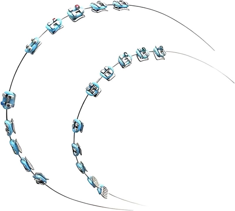 Decorative Braces: Blue Temporary Tooth Decoration - Image 1
