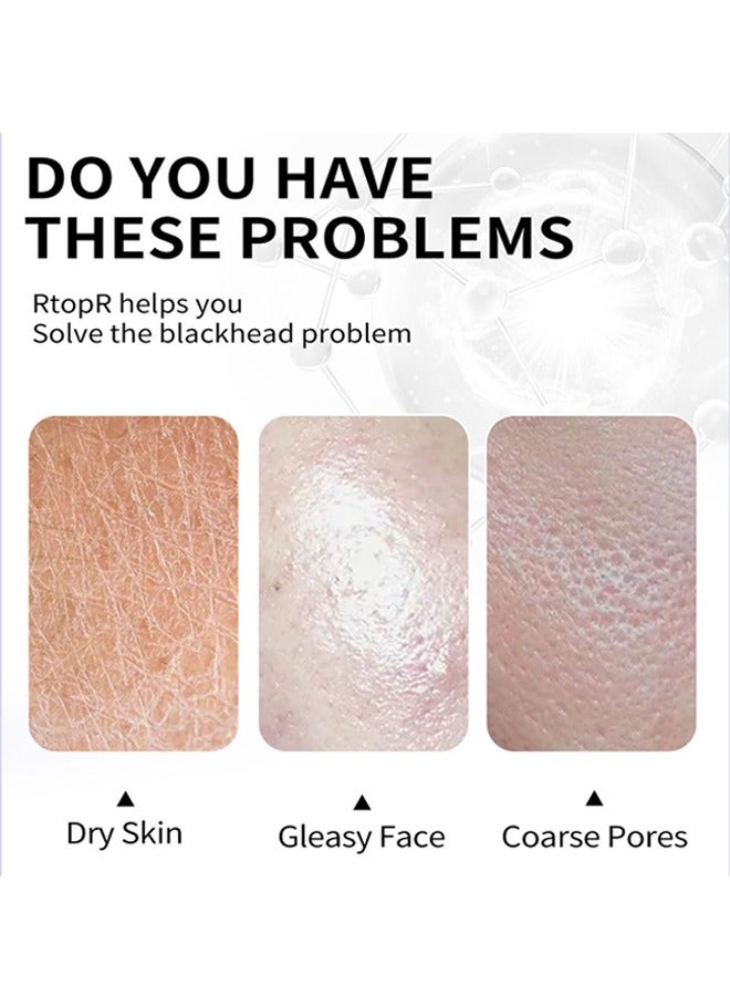 آر توب آر مانجو قناع الوجه البثرة - إزالة البشرة النظيفة المنعمة بعمق للوجه قناع الوجه بالفحم الأسود ، مزيل الرؤوس السوداء شريط مسام الأنف لجميع أنواع البشرة 40 جرام - Image 4