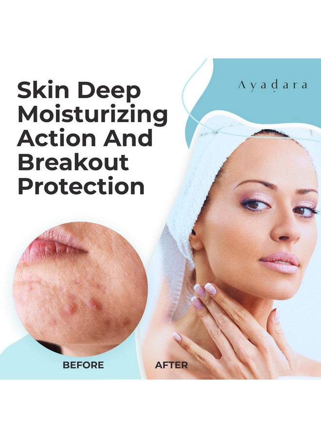 ايدارا كريم Breakout Warrior لعلاج حب الشباب، عبوة تكفي لمدة 90 يومًا، مرطب لحب الشباب للوجه والجسم، علاج حب الشباب بحمض الساليسيليك، مرطب للوجه لعلاج حب الشباب للبشرة الدهنية والرؤوس السوداء والرؤوس البيضاء، لجميع أنواع البشرة - Image 2